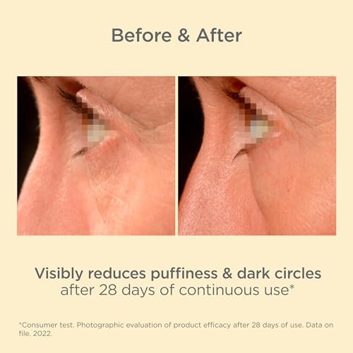 ISDIN Isdinceutics K-Ox Eyes - Rich Vitamin K Oxide Eye Cream for Dark Circles and Under-Eye Rejuvenation, 0.5 OZ Avelisse