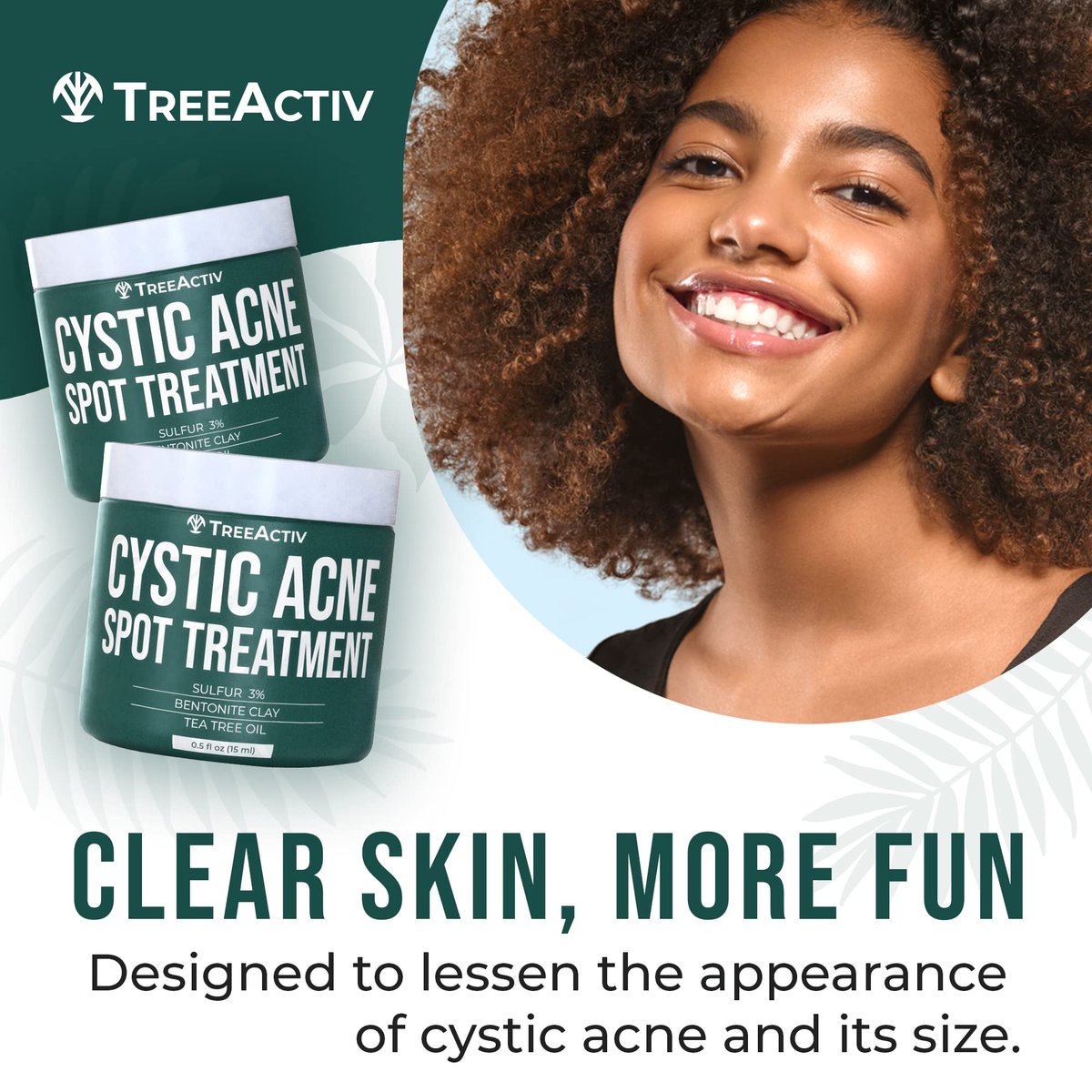 TreeActiv Cystic Acne Spot Treatment Paste with Sulfur, Bentonite Clay, and Tea Tree Oil - Deep Breakouts, 20-Minute or Overnight Application, 0.5 oz Avelisse