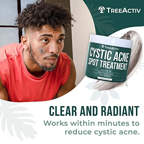 TreeActiv Cystic Acne Spot Treatment Paste with Sulfur, Bentonite Clay, and Tea Tree Oil - Deep Breakouts, 20-Minute or Overnight Application, 0.5 oz Avelisse