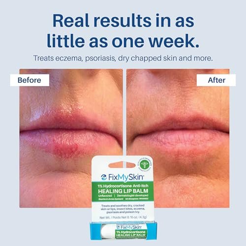 FixMySkin 1% Hydrocortisone Healing Lip Balm – Soothes Dry, Cracked & Irritated Lips, Unflavored, 0.15 oz Travel Tube - görsel 10