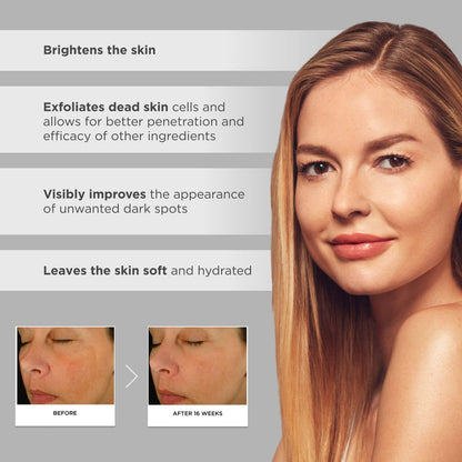 Glytone Enhance Brightening Complex - 12% Azelaic Acid & 3% Glycolic Acid - Brightens Skin, Reduces Dark Spots - Non-Comedogenic - 1 fl. oz. Avelisse