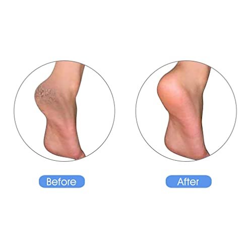 KuuCare Natural Earth Lava Pumice Stone for Feet - Foot Callus Remover, Heel Exfoliator & Dead Skin Scrubber (Black, 1 Pack) - görsel 10