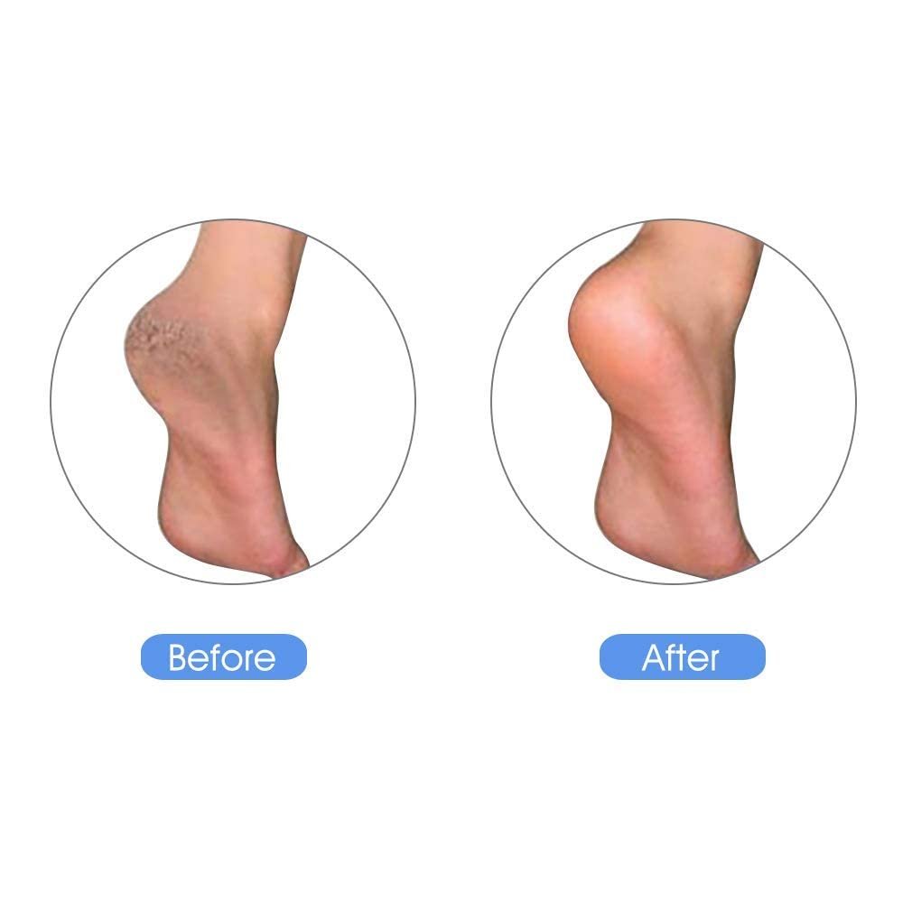 KuuCare Natural Earth Lava Pumice Stone for Feet - Foot Callus Remover, Heel Exfoliator & Dead Skin Scrubber (Black, 1 Pack) - görsel 9