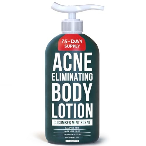 TreeActiv Acne Eliminating Body Lotion - Cucumber Mint Scent, 8 fl oz - Clears Body, Back, Butt and Shoulder Acne - Anti-Acne Moisturizer - Prevents Future Breakouts Avelisse