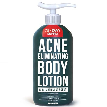 TreeActiv Acne Eliminating Body Lotion - Cucumber Mint Scent, 8 fl oz - Clears Body, Back, Butt and Shoulder Acne - Anti-Acne Moisturizer - Prevents Future Breakouts Avelisse