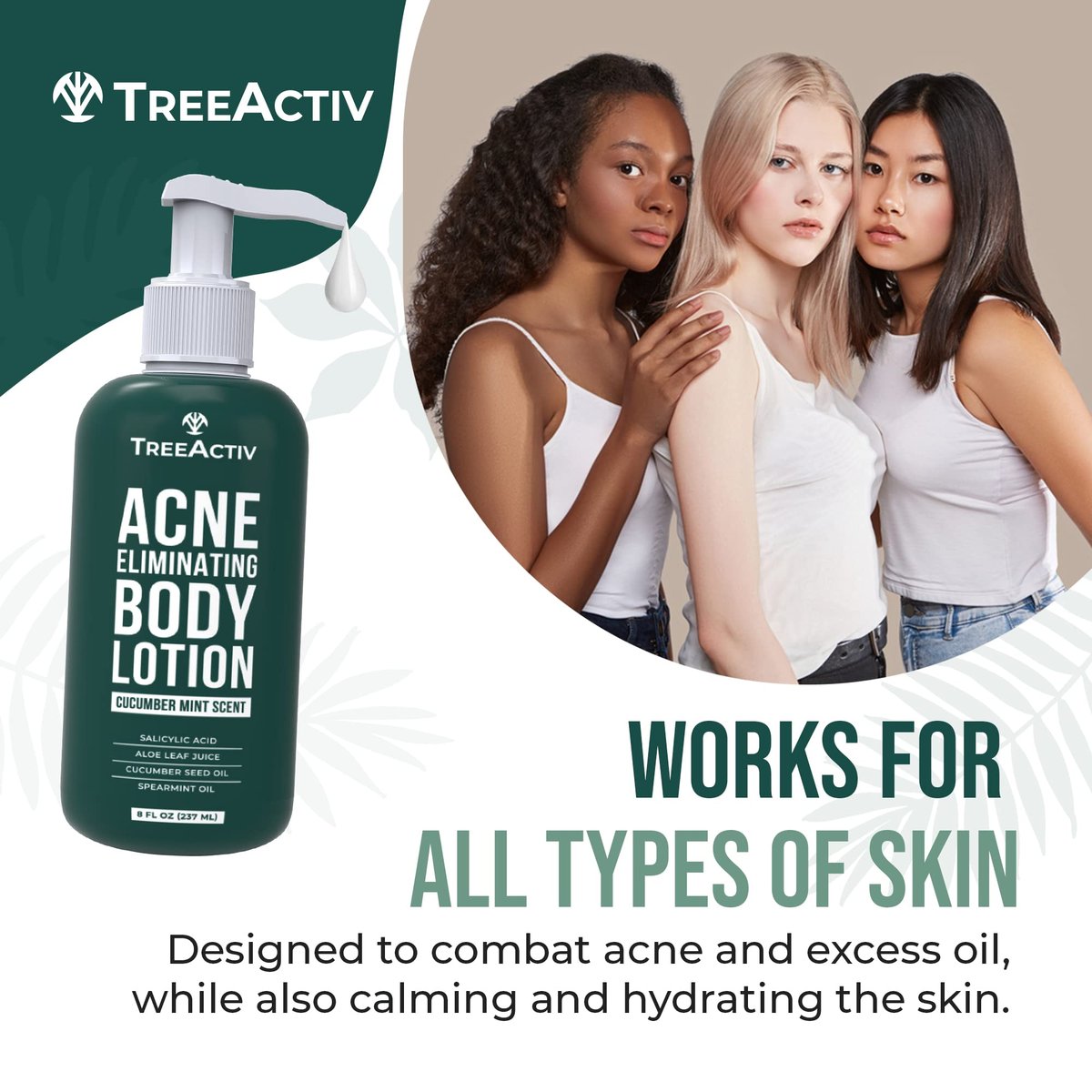 TreeActiv Acne Eliminating Body Lotion - Cucumber Mint Scent, 8 fl oz - Clears Body, Back, Butt and Shoulder Acne - Anti-Acne Moisturizer - Prevents Future Breakouts Avelisse
