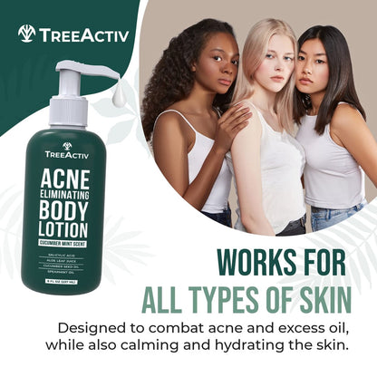 TreeActiv Acne Eliminating Body Lotion - Cucumber Mint Scent, 8 fl oz - Clears Body, Back, Butt and Shoulder Acne - Anti-Acne Moisturizer - Prevents Future Breakouts Avelisse