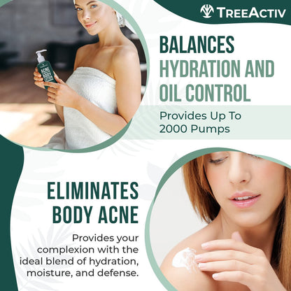 TreeActiv Acne Eliminating Body Lotion - Cucumber Mint Scent, 8 fl oz - Clears Body, Back, Butt and Shoulder Acne - Anti-Acne Moisturizer - Prevents Future Breakouts Avelisse