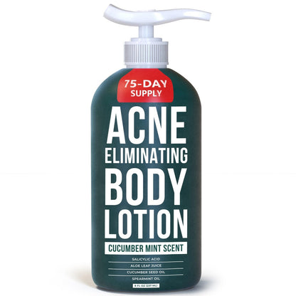 TreeActiv Acne Eliminating Body Lotion - Cucumber Mint Scent, 8 fl oz - Clears Body, Back, Butt and Shoulder Acne - Anti-Acne Moisturizer - Prevents Future Breakouts Avelisse