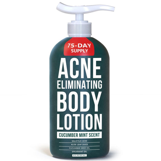 TreeActiv Acne Eliminating Body Lotion - Cucumber Mint Scent, 8 fl oz - Clears Body, Back, Butt and Shoulder Acne - Anti-Acne Moisturizer - Prevents Future Breakouts Avelisse