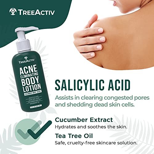TreeActiv Acne Eliminating Body Lotion - Cucumber Mint Scent, 8 fl oz - Clears Body, Back, Butt and Shoulder Acne - Anti-Acne Moisturizer - Prevents Future Breakouts Avelisse