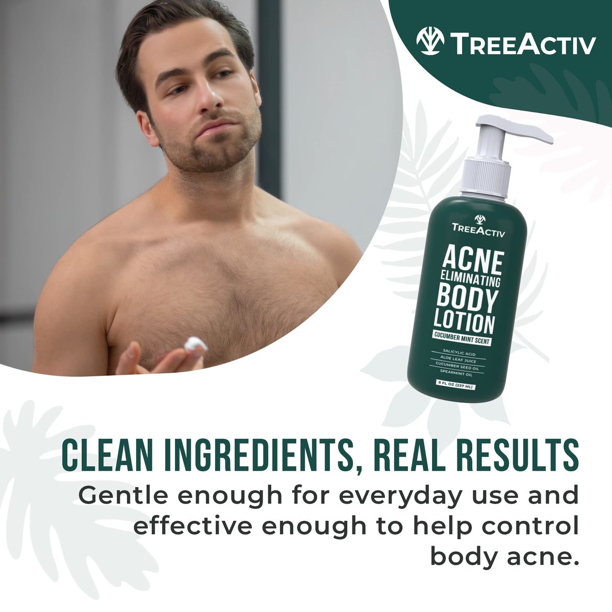 TreeActiv Acne Eliminating Body Lotion - Cucumber Mint Scent, 8 fl oz - Clears Body, Back, Butt and Shoulder Acne - Anti-Acne Moisturizer - Prevents Future Breakouts Avelisse