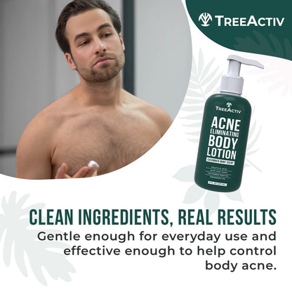 TreeActiv Acne Eliminating Body Lotion - Cucumber Mint Scent, 8 fl oz - Clears Body, Back, Butt and Shoulder Acne - Anti-Acne Moisturizer - Prevents Future Breakouts Avelisse