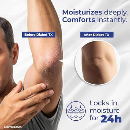 Goicoechea Diabet TX Diabetic Lotion with Urea for Dry Skin | Soothing Hydrating Cream with Aloe, Oatmeal & Vitamin E for Hands, Elbows, Feet & Body | Extra Dry Skin Support, 13.5 Oz | 1-Pack