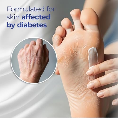Goicoechea Diabet TX Diabetic Lotion with Urea for Dry Skin | Soothing Hydrating Cream with Aloe, Oatmeal & Vitamin E for Hands, Elbows, Feet & Body | Extra Dry Skin Support, 13.5 Oz | 1-Pack - görsel 5