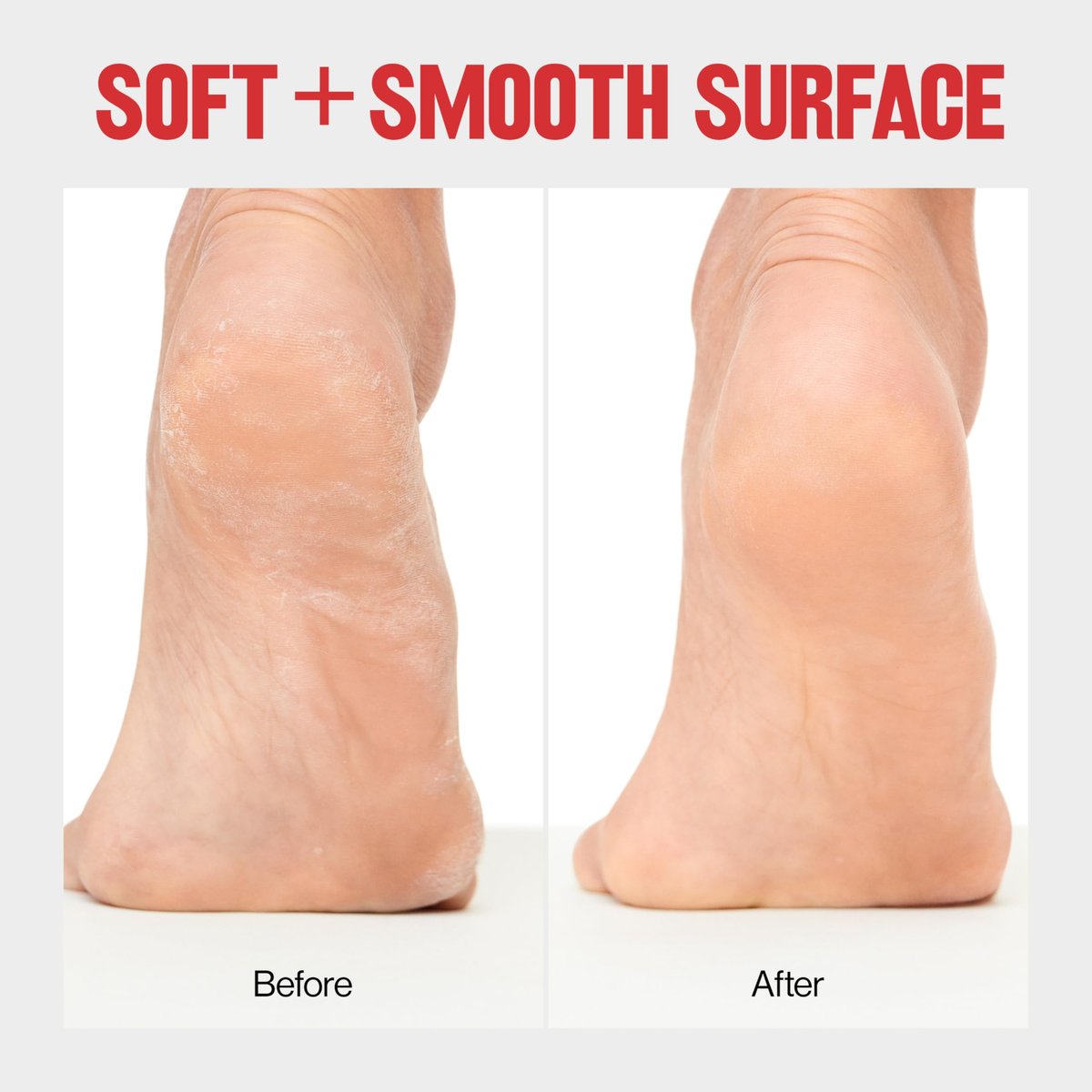 Revlon Callus Remover Foot File for Wet or Dry Skin - Gently Removes Dead Skin and Calluses, Easy to Use, Ceramic, Pack of 1 Avelisse