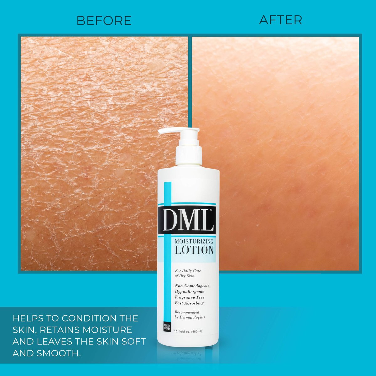 DML Moisturizing Lotion - 16 Fl Oz | Intense Hydration for Dry Skin Avelisse