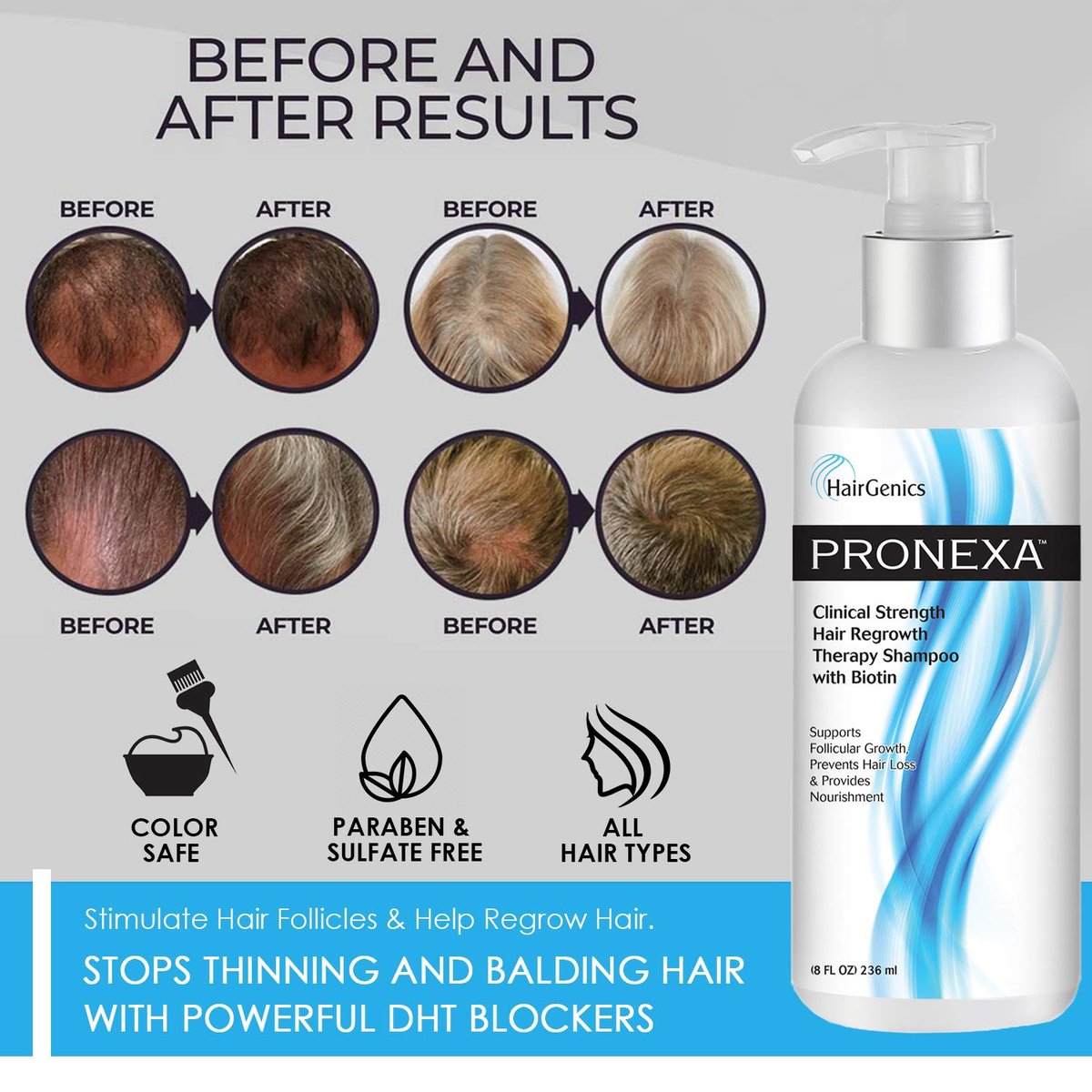 Pronexa Clinical Strength Hair Growth & Regrowth Therapy Shampoo with Biotin, Collagen & DHT Blockers for Thinning Hair, 8 fl. oz. Avelisse