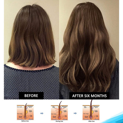 Pronexa Clinical Strength Hair Growth & Regrowth Therapy Shampoo with Biotin, Collagen & DHT Blockers for Thinning Hair, 8 fl. oz. Avelisse