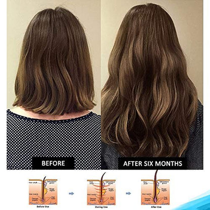Pronexa Clinical Strength Hair Growth & Regrowth Therapy Shampoo with Biotin, Collagen & DHT Blockers for Thinning Hair, 8 fl. oz. Avelisse