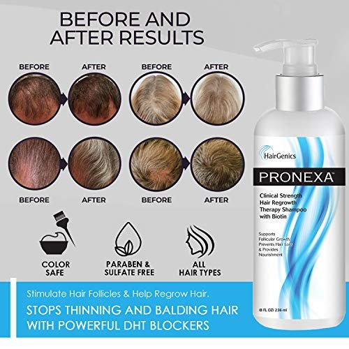 Pronexa Clinical Strength Hair Growth & Regrowth Therapy Shampoo with Biotin, Collagen & DHT Blockers for Thinning Hair, 8 fl. oz. Avelisse