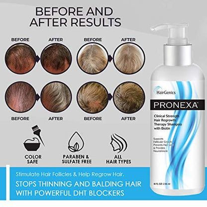 Pronexa Clinical Strength Hair Growth & Regrowth Therapy Shampoo with Biotin, Collagen & DHT Blockers for Thinning Hair, 8 fl. oz. Avelisse