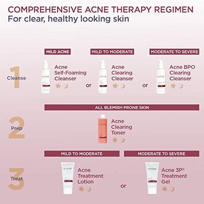 Glytone Acne BPO Treatment Gel - 5% Benzoyl Peroxide Spot Treatment for Cystic Acne & Breakouts - Non-Comedogenic, Time-Released Formula for Oily, Blemish-Prone Skin - 2 fl oz Avelisse
