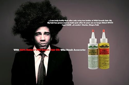 Wild Growth Hair Oil - 4 oz | Natural Hair Regrowth Treatment for Men & Women