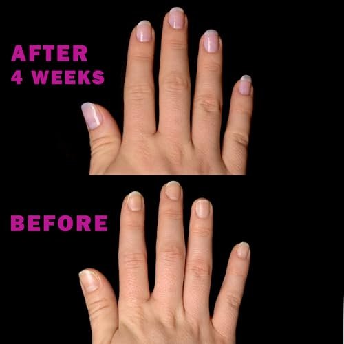 Perfect Formula Nail Essentials Kit – 4-Piece Keratin Nail Strengthener & Growth Treatment for Damaged Nails | High Gloss Finish Avelisse