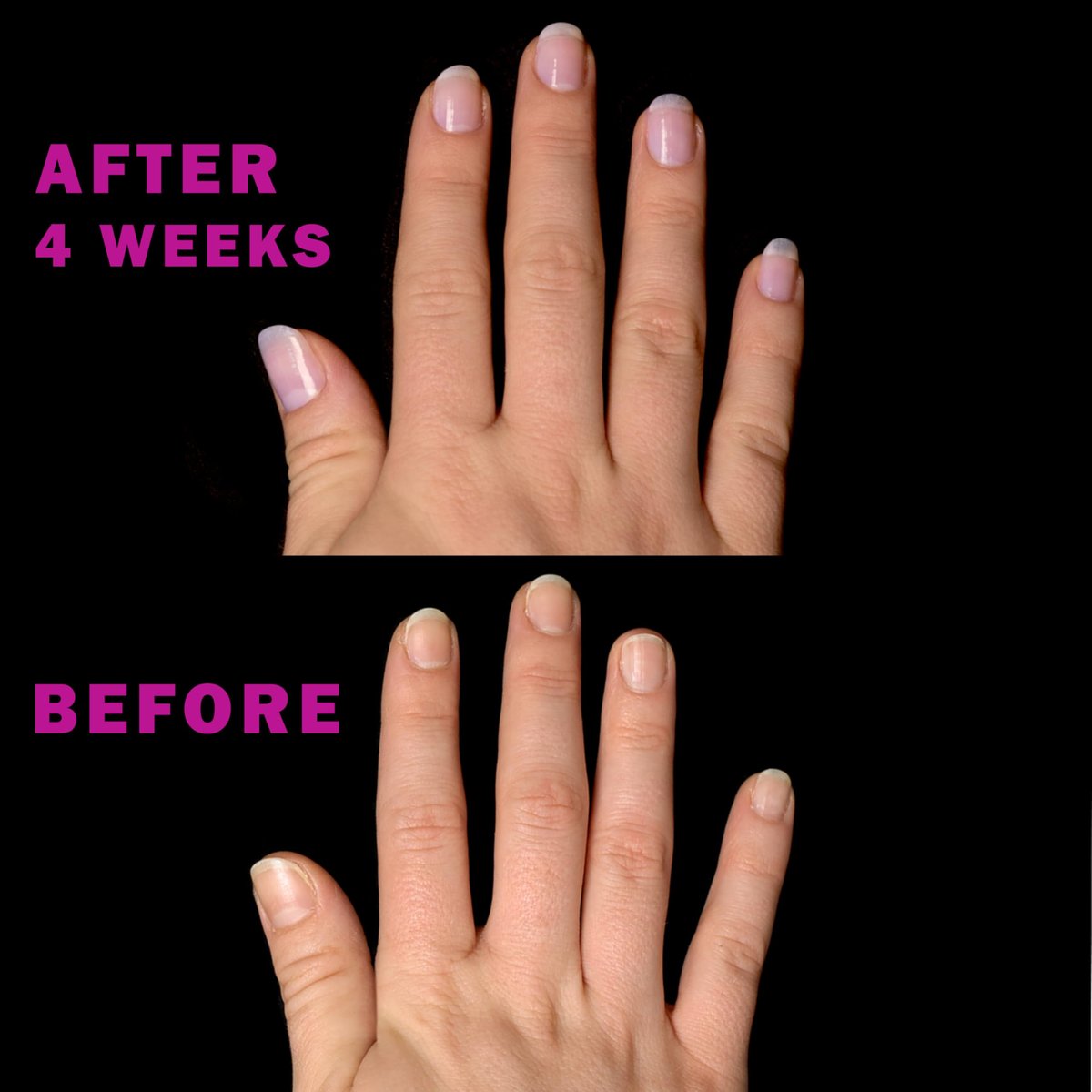 Perfect Formula Nail Essentials Kit – 4-Piece Keratin Nail Strengthener & Growth Treatment for Damaged Nails | High Gloss Finish Avelisse