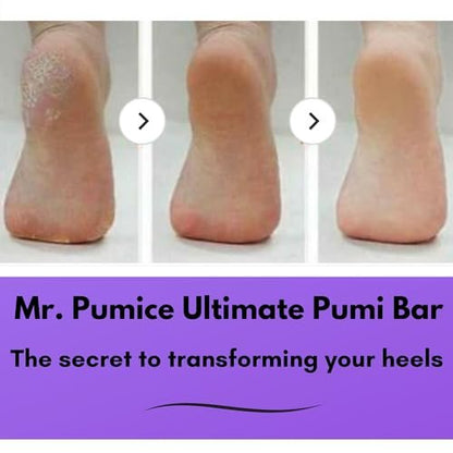 Mr. Pumice Ultimate PUMI Bar 2-in-1 Dual Grit Callus Remover for Smooth Feet and Heels (4 Pack)
