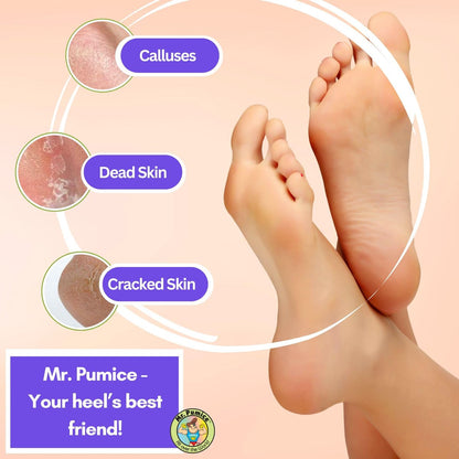 Mr. Pumice Ultimate PUMI Bar 2-in-1 Dual Grit Callus Remover for Smooth Feet and Heels (4 Pack)