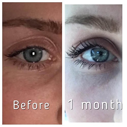 Pronexa Hairgenics Lavish Lash - Eyelash Growth Enhancer & Brow Serum with Biotin & Natural Growth Peptides for Long, Thick Lashes and Eyebrows - Dermatologist Certified, Cruelty Free & Hypoallergenic Avelisse