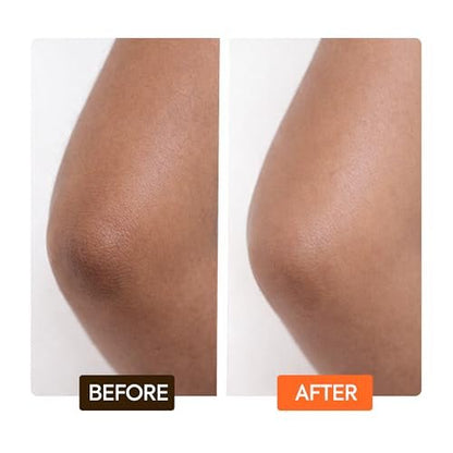 MAKARI Carotonic Extreme Body Lotion – Fights Excess Oil, Fades Scars & Marks, Brightens Skin (17.6 oz) Avelisse