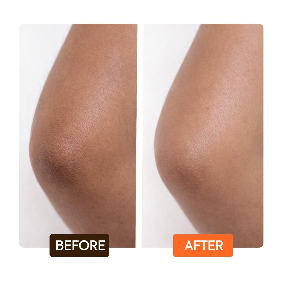 MAKARI Carotonic Extreme Body Lotion – Fights Excess Oil, Fades Scars & Marks, Brightens Skin (17.6 oz) Avelisse