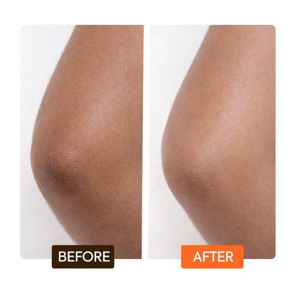 MAKARI Carotonic Extreme Body Lotion – Fights Excess Oil, Fades Scars & Marks, Brightens Skin (17.6 oz) Avelisse