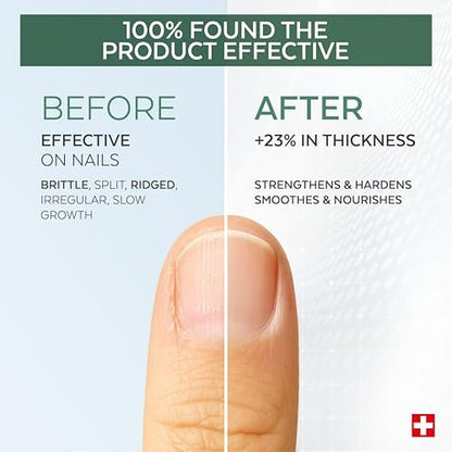 PODERM 100% Natural Nail Repair – Revitalizes Damaged & Split Nails with Hydrating & Exfoliating Formula – Swiss Made Nail Strengthener (0.27 Fl Oz)
