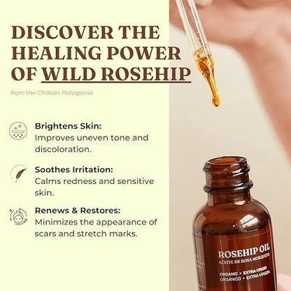Offernova Organic Rosa de Mosqueta Oil - USDA Certified Rosehip Seed Oil, Cold Pressed, 1 oz Avelisse