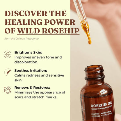 Offernova Organic Rosa de Mosqueta Oil - USDA Certified Rosehip Seed Oil, Cold Pressed, 1 oz Avelisse