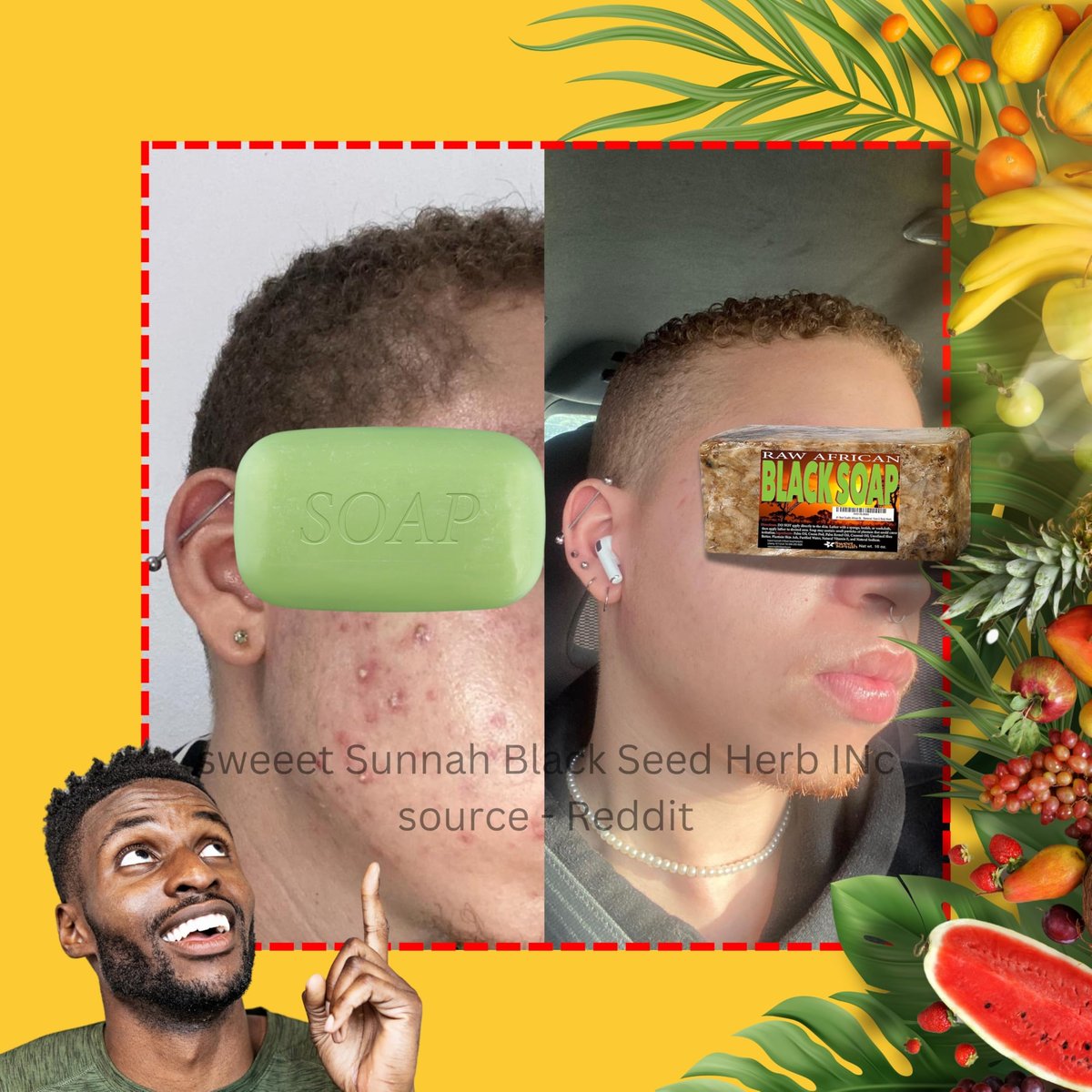 Premium African Black Soap - Pure 1 Pound Bulk - Raw Organic Soap for Acne, Dry Skin, Rashes, Burns, Scar Removal, Face & Body Wash - Authentic Ghana West Africa Moisturizer - görsel 13