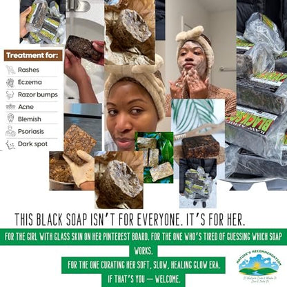 Premium African Black Soap - Pure 1 Pound Bulk - Raw Organic Soap for Acne, Dry Skin, Rashes, Burns, Scar Removal, Face & Body Wash - Authentic Ghana West Africa Moisturizer