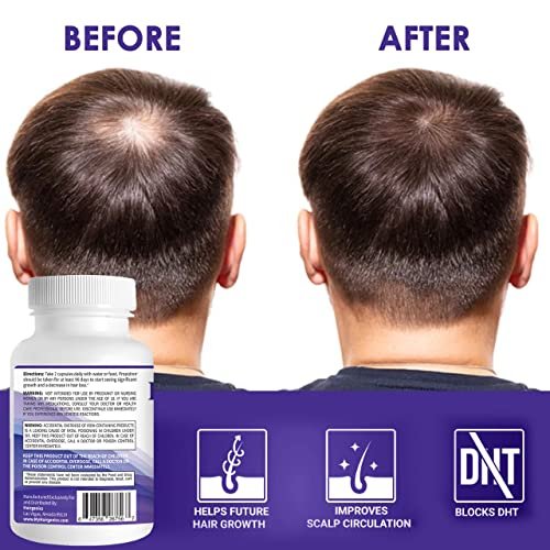 Propidren by HairGenics - DHT Blocker & Hair Growth Capsules | Natural Hair Regrowth Treatment for Men & Women Avelisse