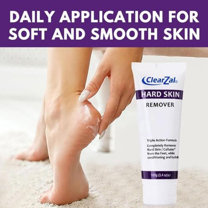 Clearzal Foot Cream for Hard Skin – Triple Action Formula with Aloe Vera, 3.4 oz – Softens Calluses & Corns, Hydrates Dry Feet Avelisse