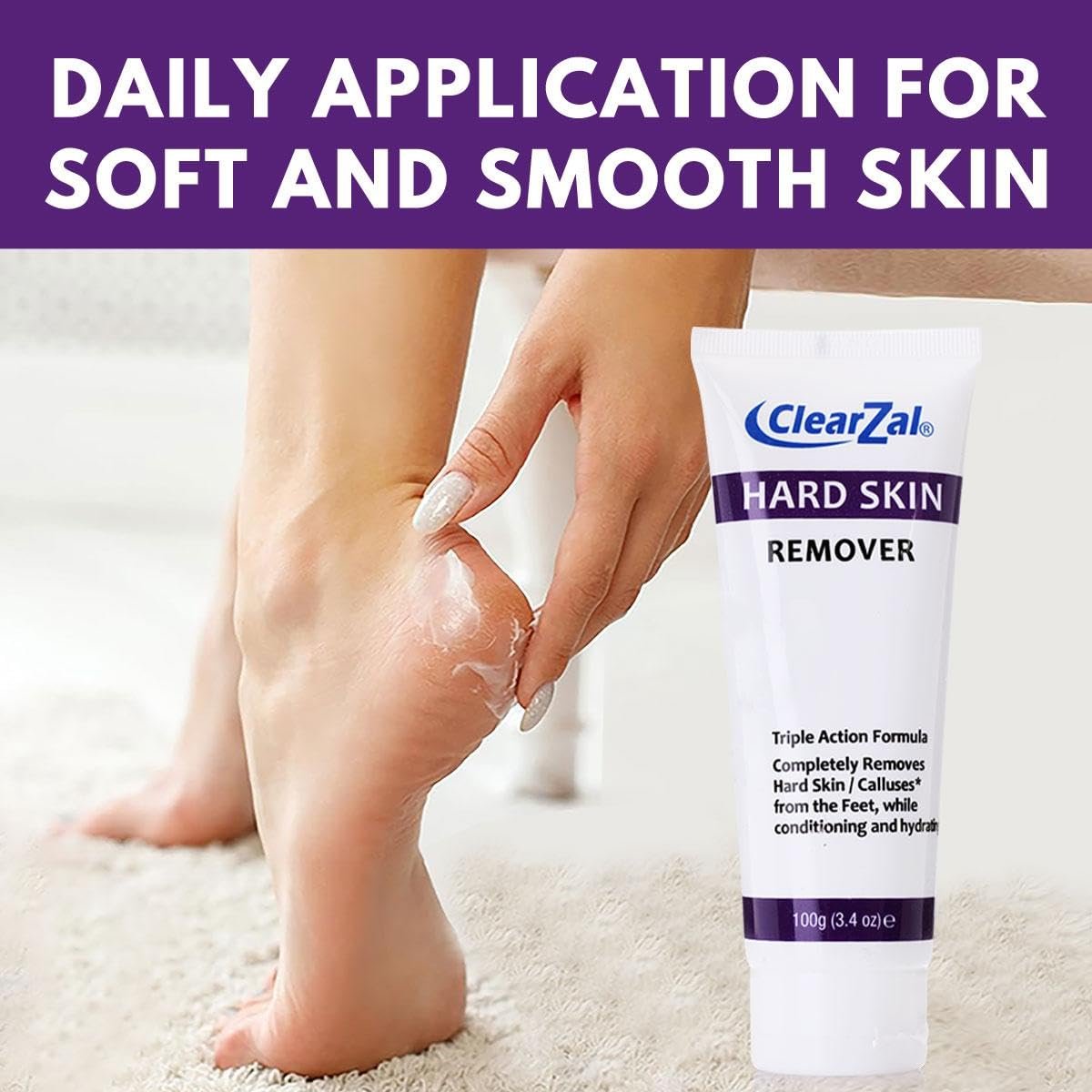Clearzal Foot Cream for Hard Skin – Triple Action Formula with Aloe Vera, 3.4 oz – Softens Calluses & Corns, Hydrates Dry Feet Avelisse