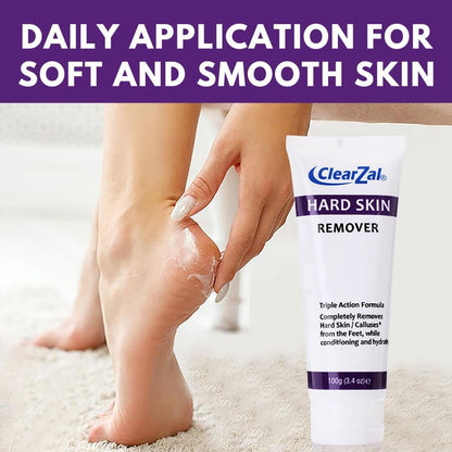 Clearzal Foot Cream for Hard Skin – Triple Action Formula with Aloe Vera, 3.4 oz – Softens Calluses & Corns, Hydrates Dry Feet Avelisse