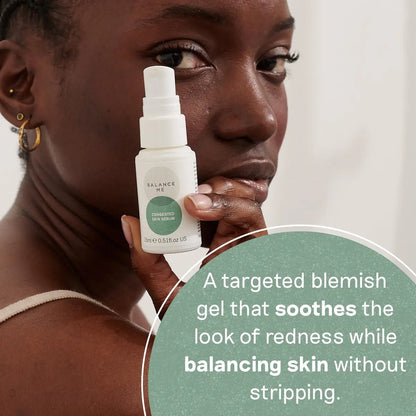 Balance Me Congested Skin Serum - Natural Acne Treatment with Kanuka & Moringa, Non-Drying Spot Serum for Oily, Combination & Sensitive Skin (0.5 fl oz) Avelisse