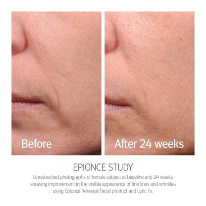 Epionce Renewal Facial Lotion – Hydrating Anti-Aging Moisturizer for Normal to Combination Skin, Reduces Fine Lines & Wrinkles, Dermatologist-Developed Skincare Avelisse