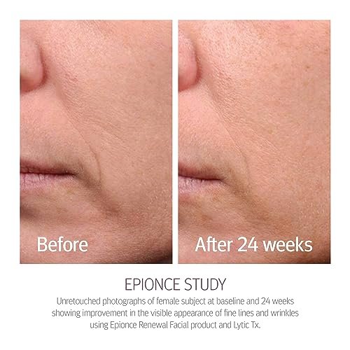 Epionce Renewal Facial Lotion – Hydrating Anti-Aging Moisturizer for Normal to Combination Skin, Reduces Fine Lines & Wrinkles, Dermatologist-Developed Skincare Avelisse
