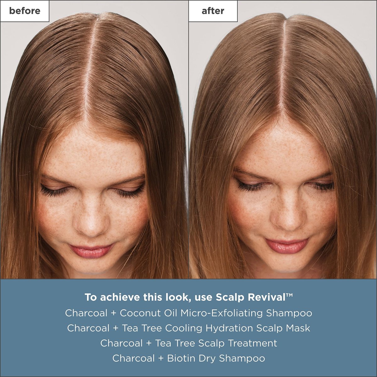Briogeo Scalp Revival Charcoal + Tea Tree Scalp Treatment - Leave-In Serum for Dry, Flaky, or Itchy Scalp - Hydrating & Balancing - Vegan & Cruelty Free - 1 oz Avelisse