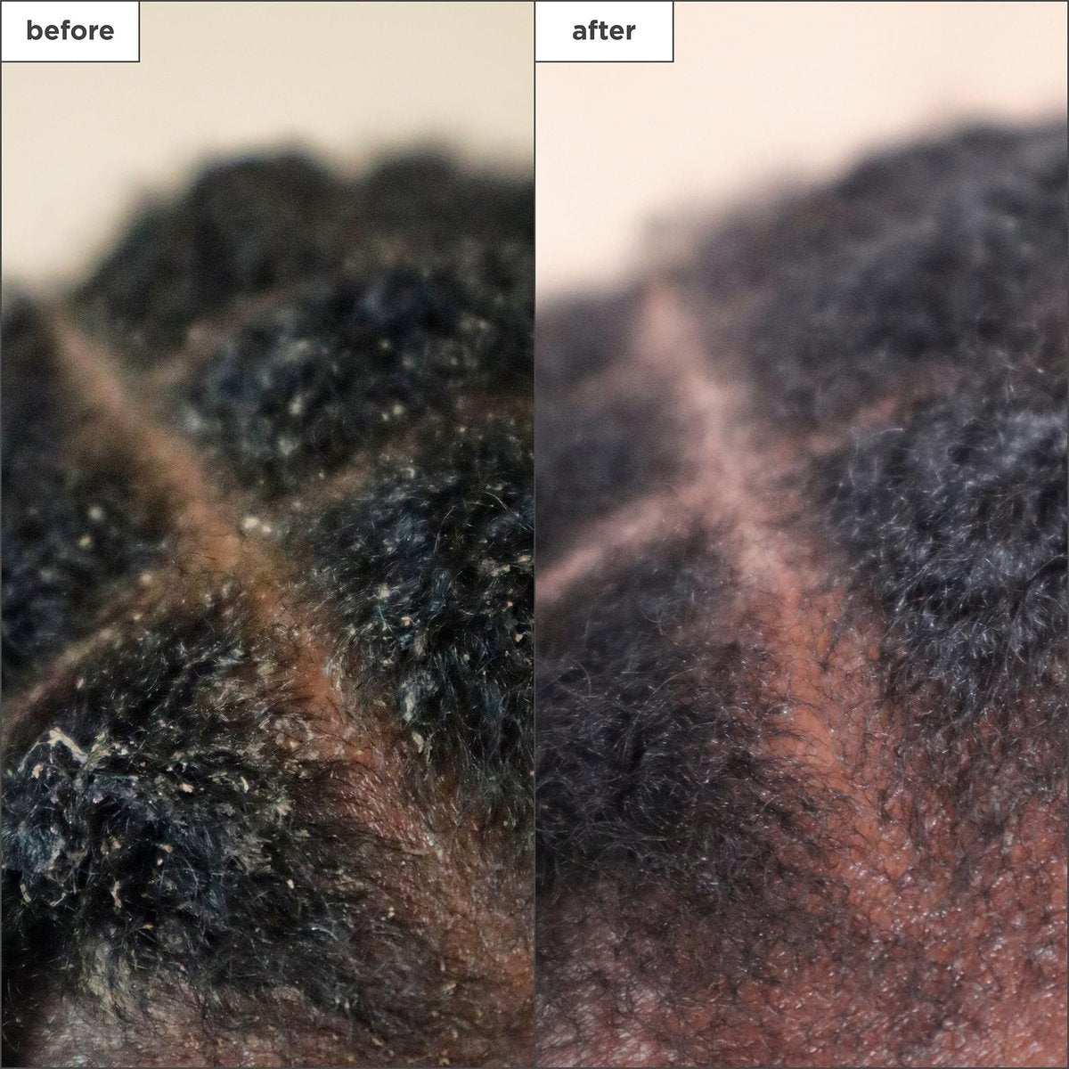Briogeo Scalp Revival Charcoal + Tea Tree Scalp Treatment - Leave-In Serum for Dry, Flaky, or Itchy Scalp - Hydrating & Balancing - Vegan & Cruelty Free - 1 oz Avelisse